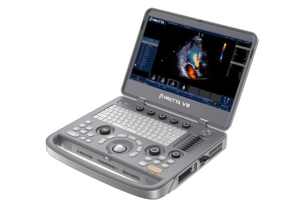 Pretta V8 Taşınabilir Renkli Ultrason